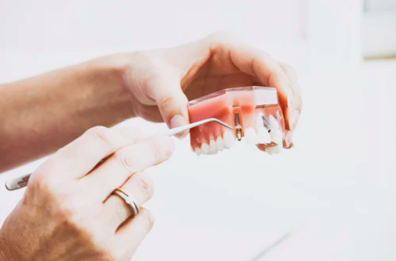 Dental Crowns